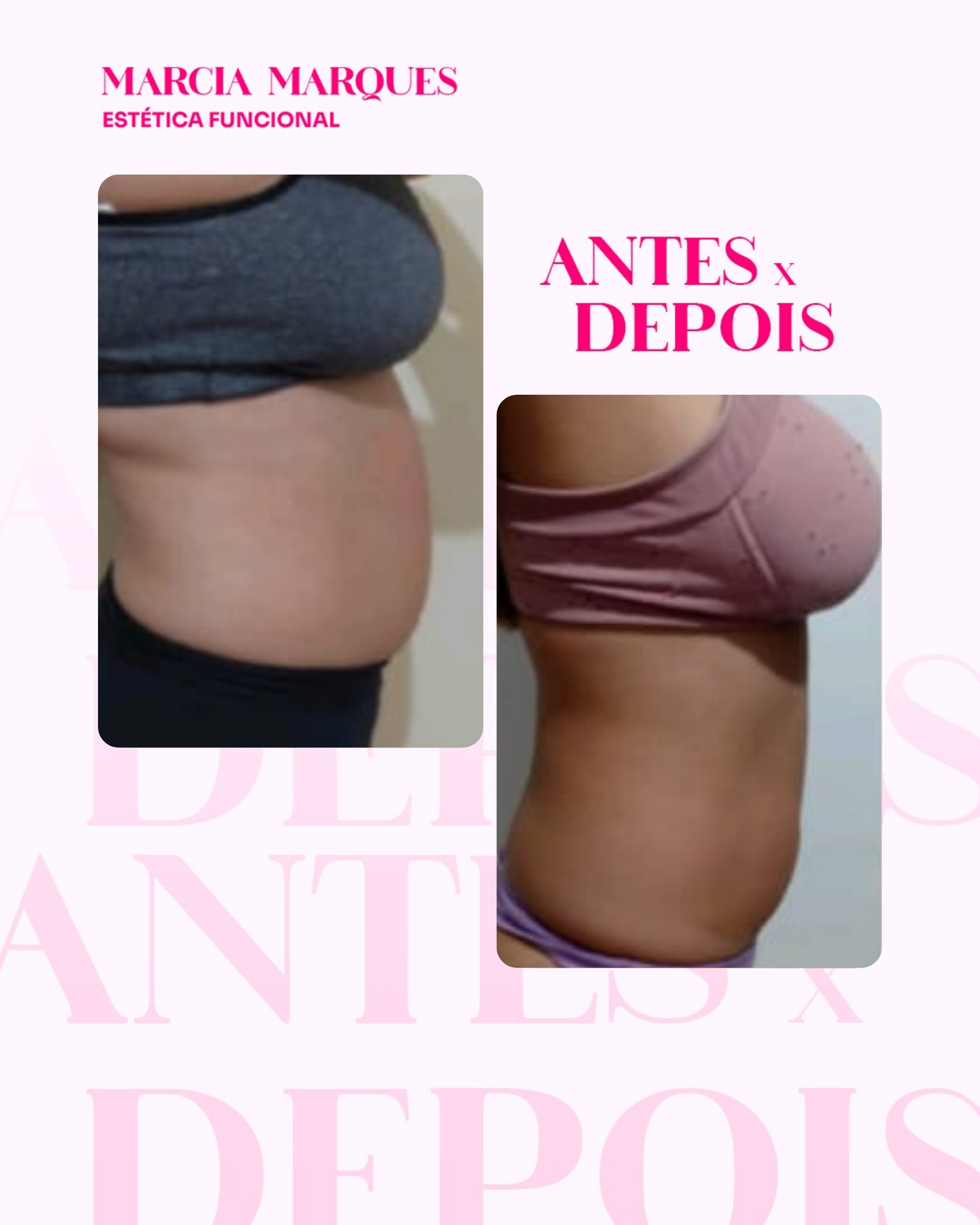 Antes e Depois 3
